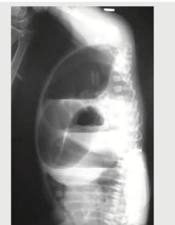 Image for question 127