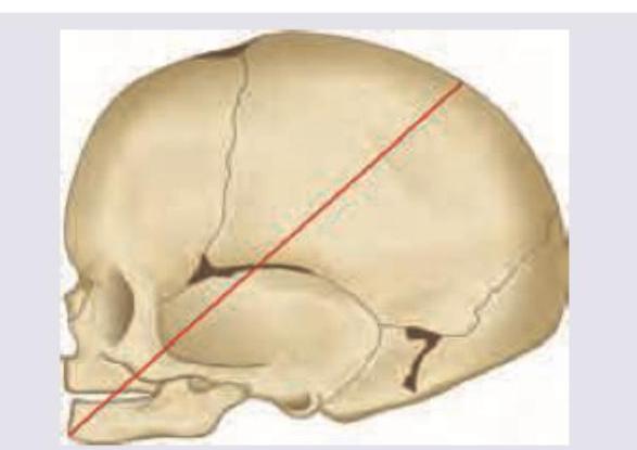 Image for question 835