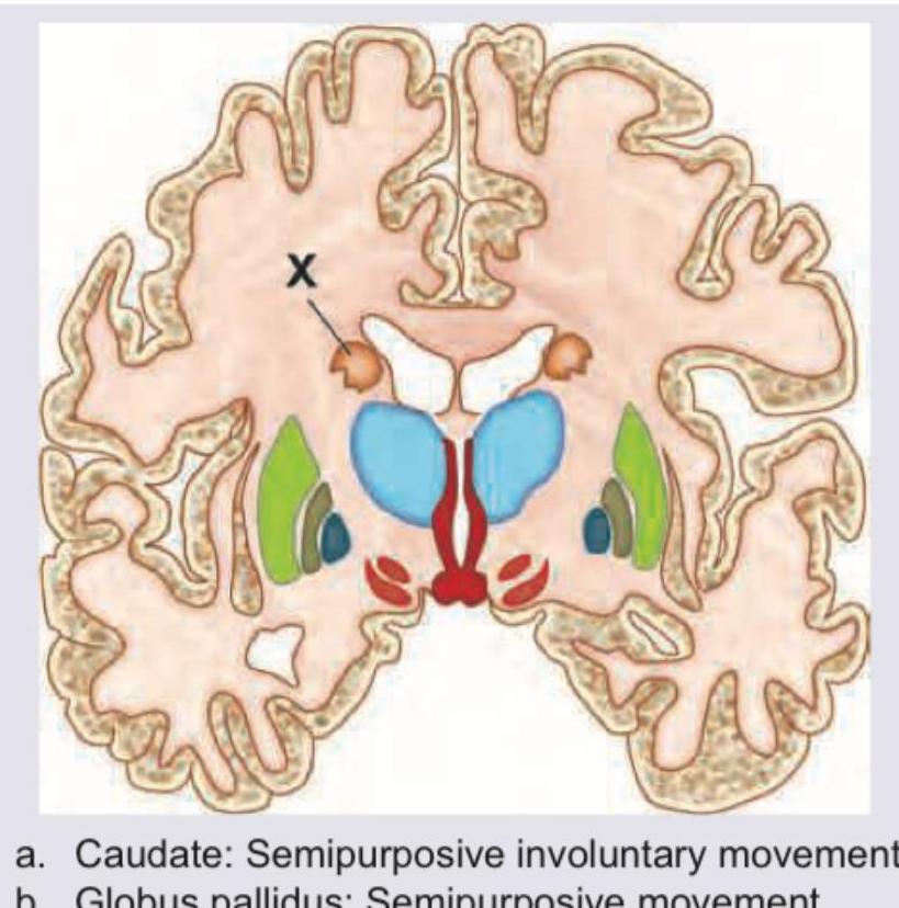 Image for question 9