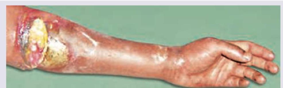 Image for question 90