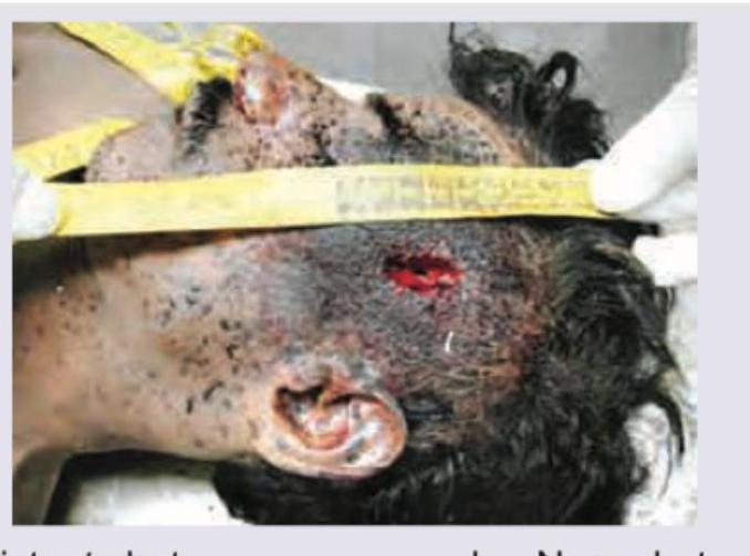 Image for question 499