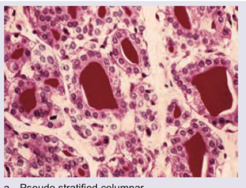 Image for question 389