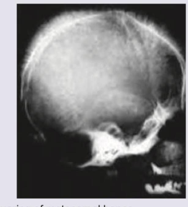 Image for question 171