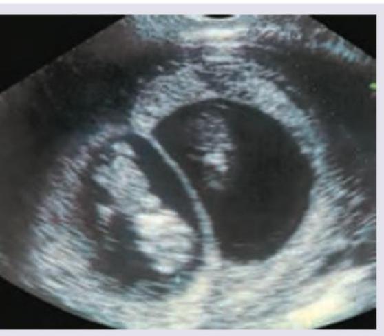 Image for question 163