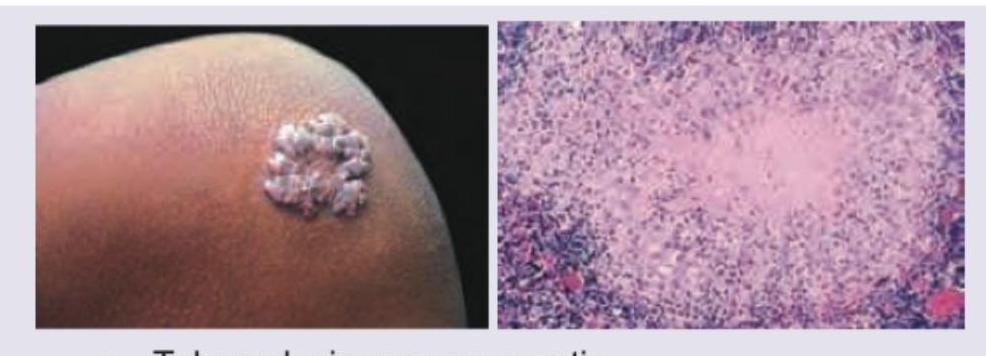 Image for question 163