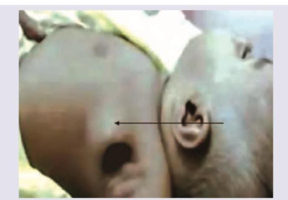 Image for question 351