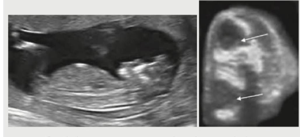 Image for question 949