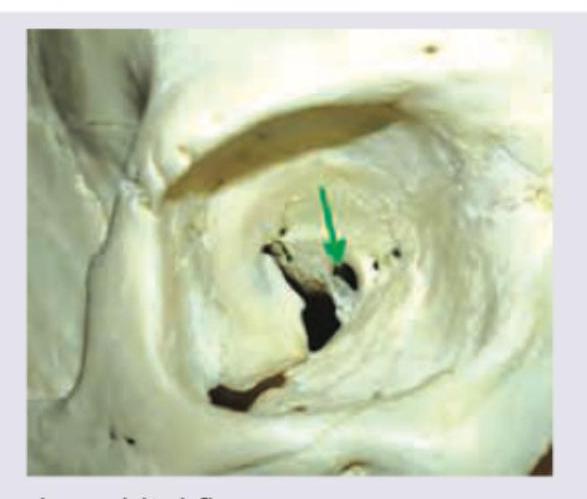 Image for question 64