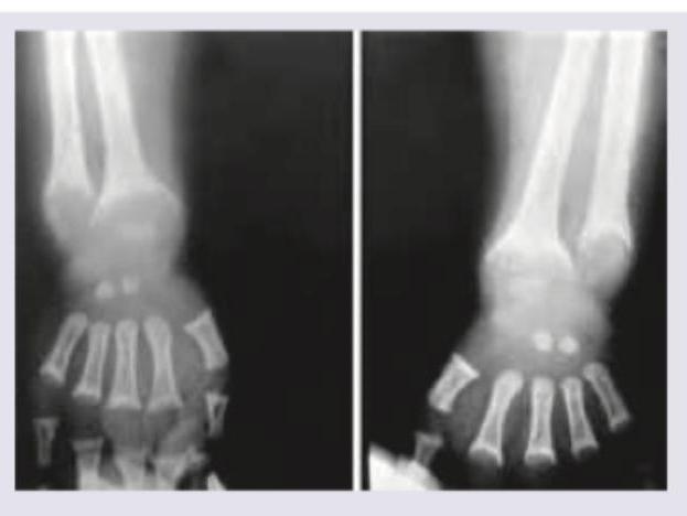 Image for question 632