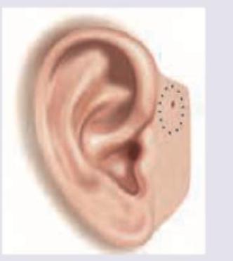 Image for question 198