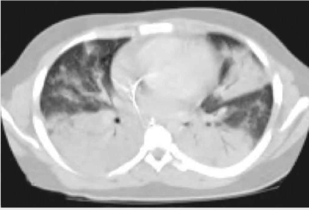 Image for question 388