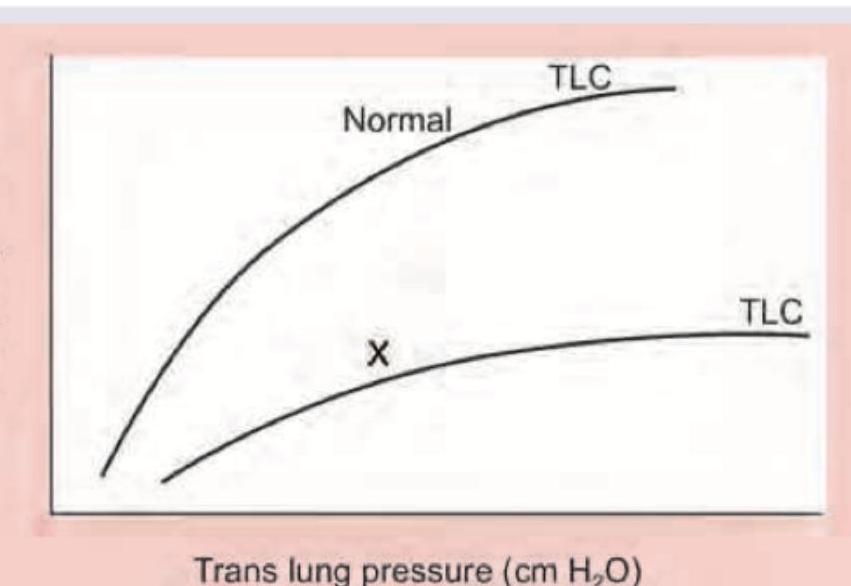 Image for question 372