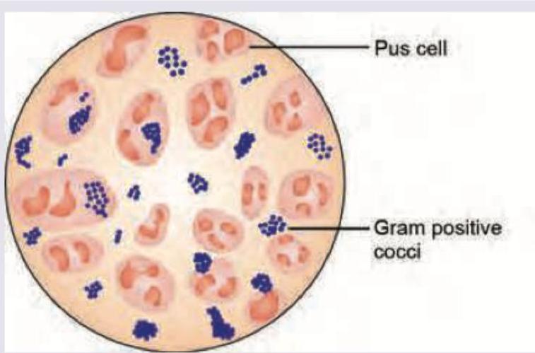 Image for question 2069