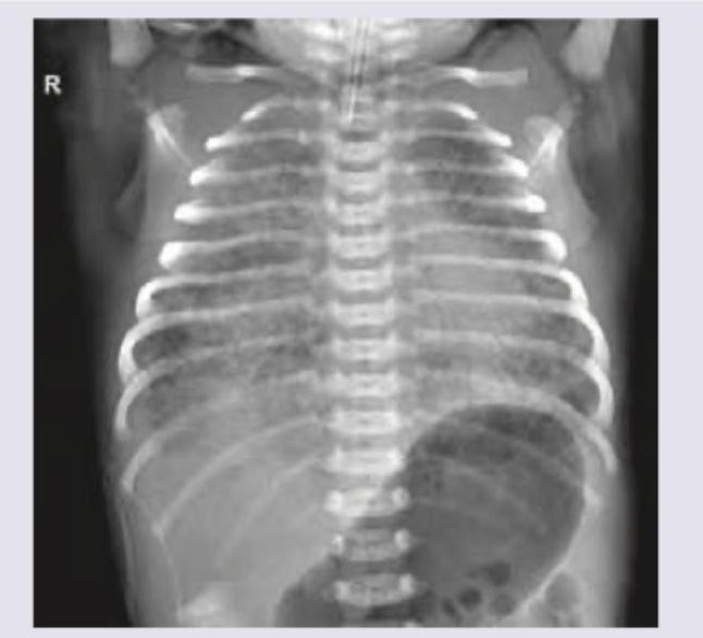 Image for question 747