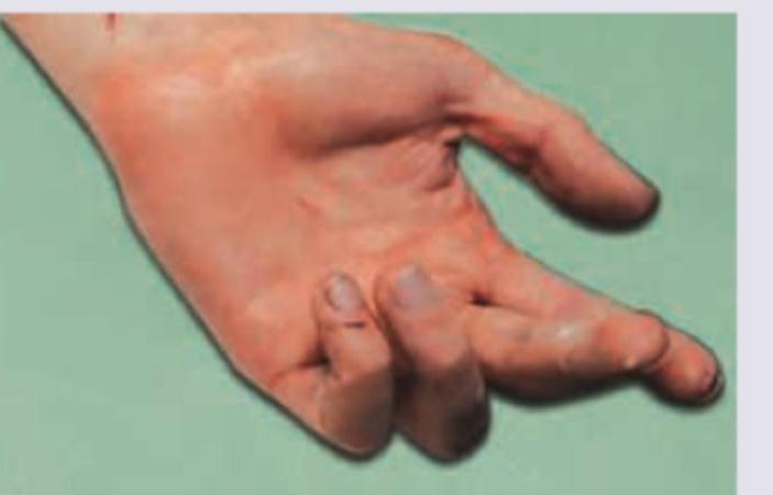 Image for question 77