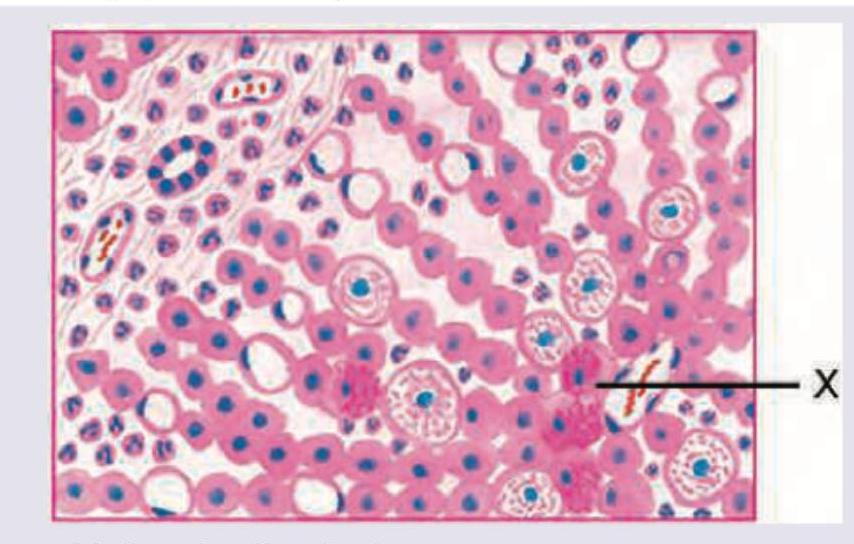 Image for question 350