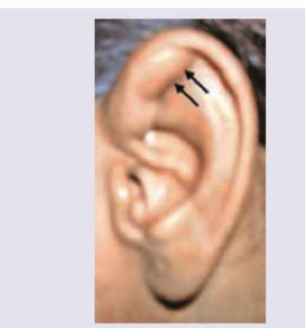 Image for question 197