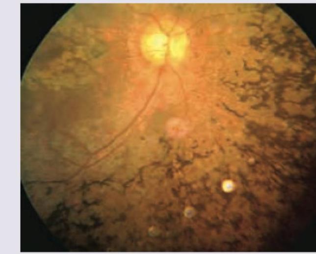 Image for question 452