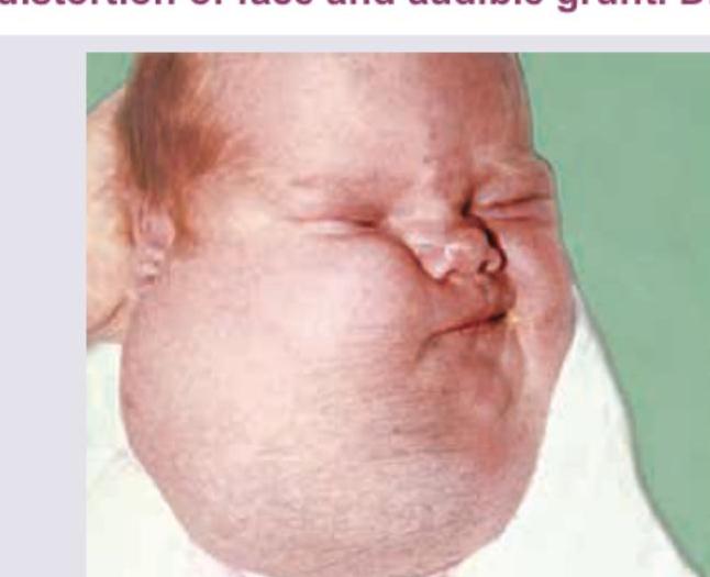 Image for question 744