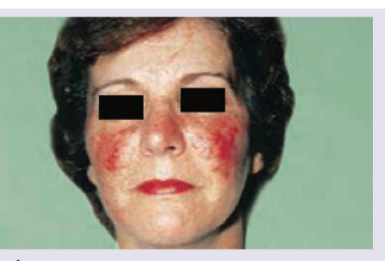 Image for question 245