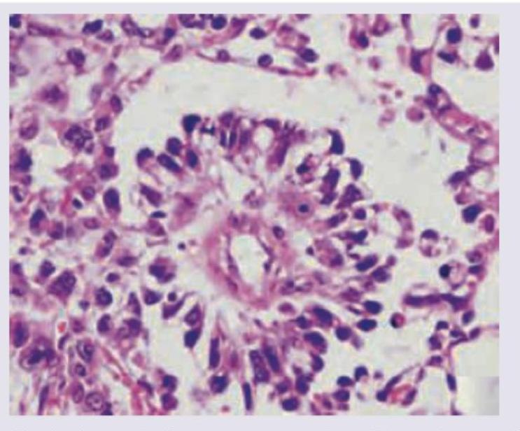 Image for question 689