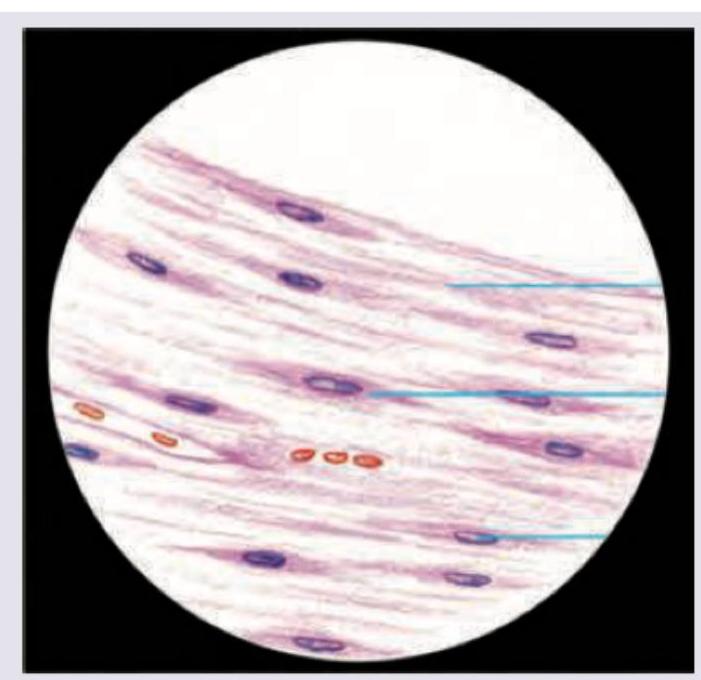 Image for question 399