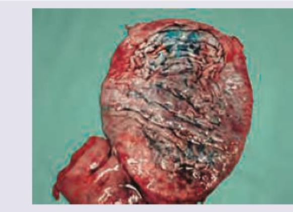 Image for question 771