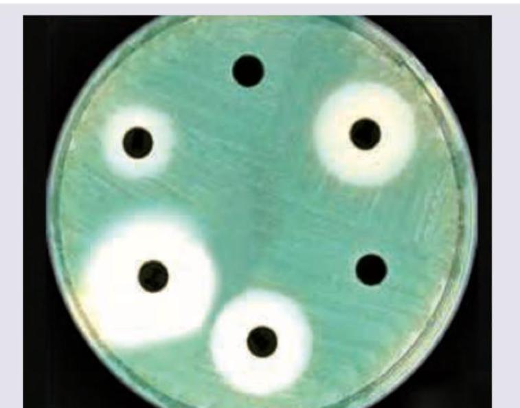 Image for question 117