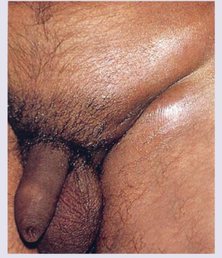 Image for question 73