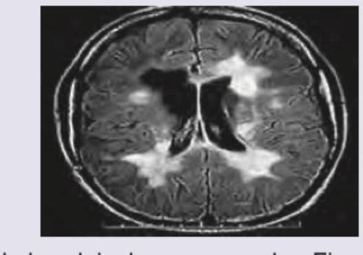 Image for question 681