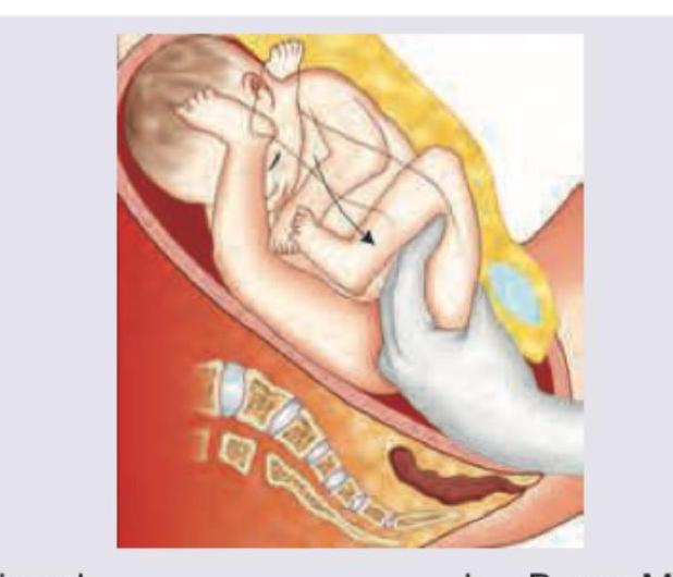 Image for question 200