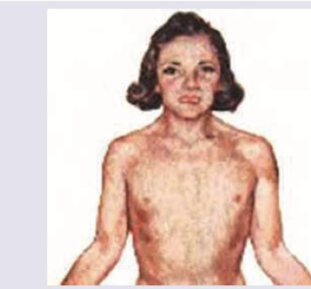 Image for question 290