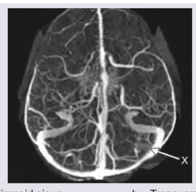 Image for question 365