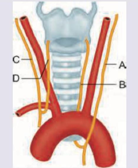 Image for question 200