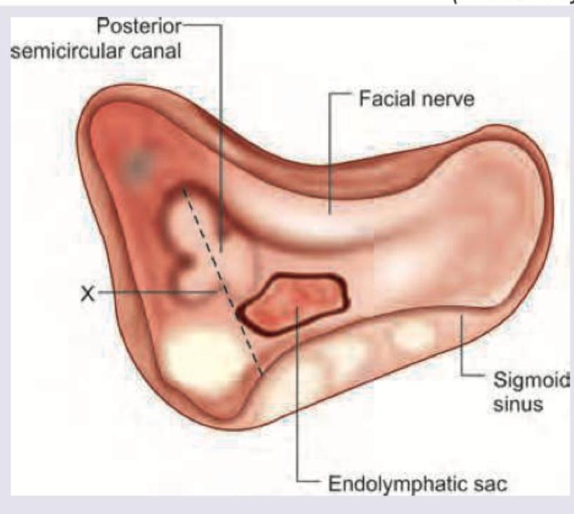 Image for question 290