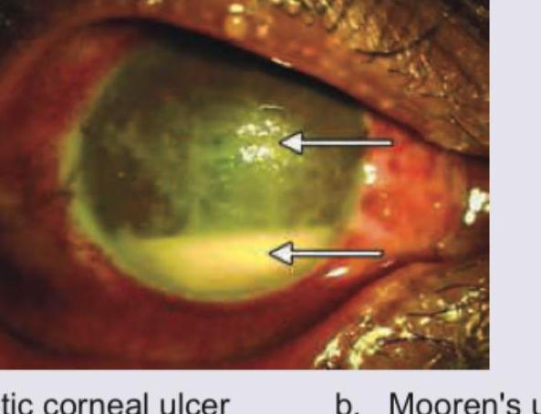 Image for question 319