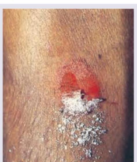 Image for question 79