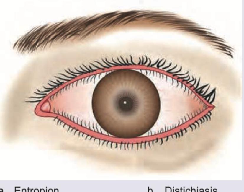 Image for question 41