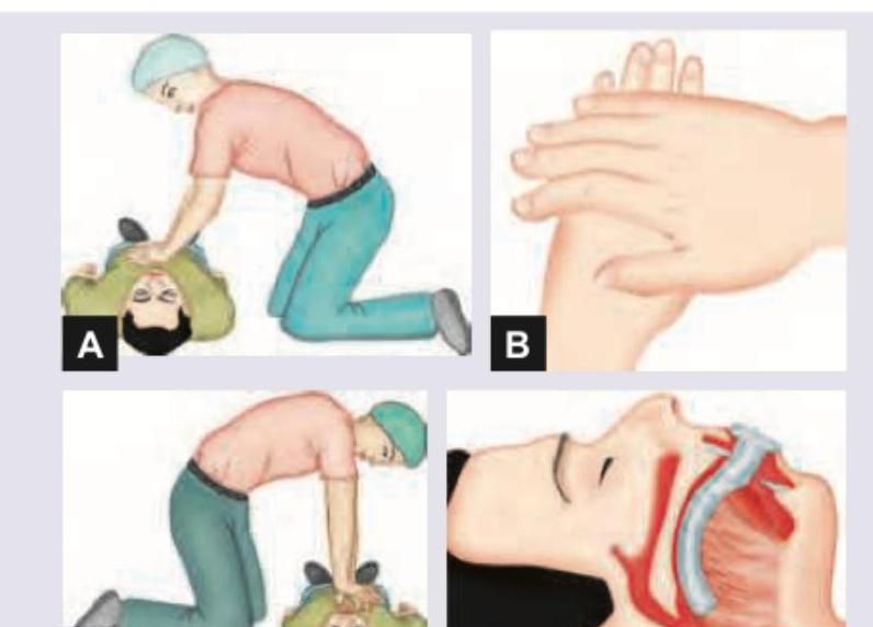 Image for question 71