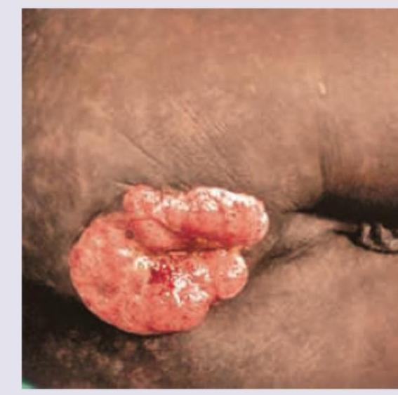 Image for question 244