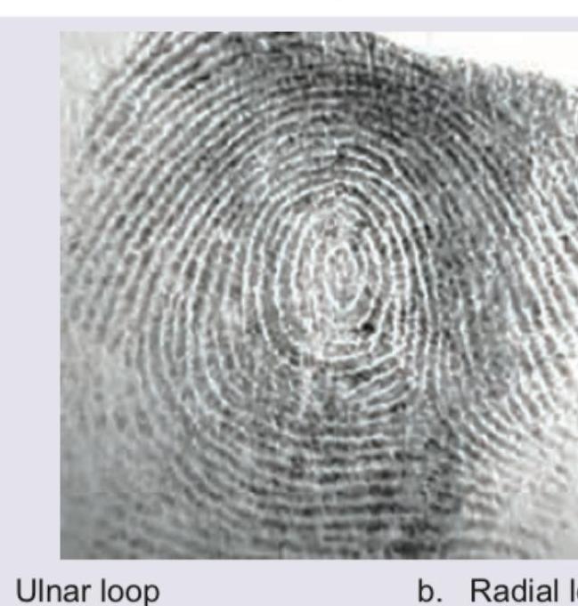 Image for question 303