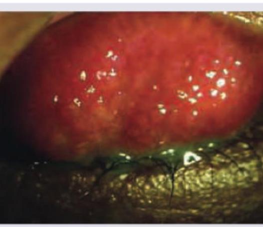 Image for question 261