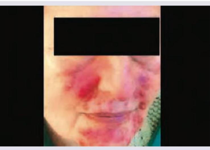 Image for question 54