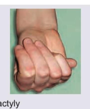 Image for question 71