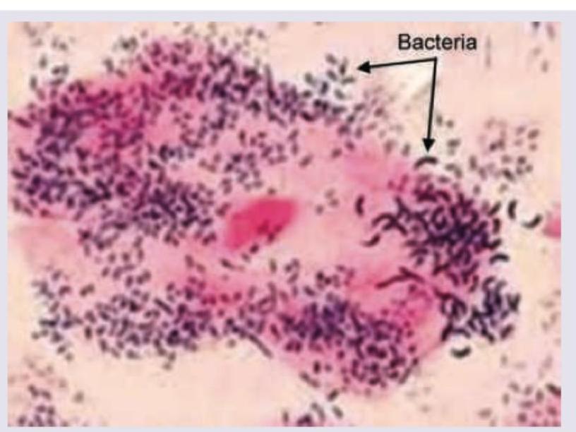 Image for question 909