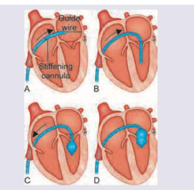 Image for question 61