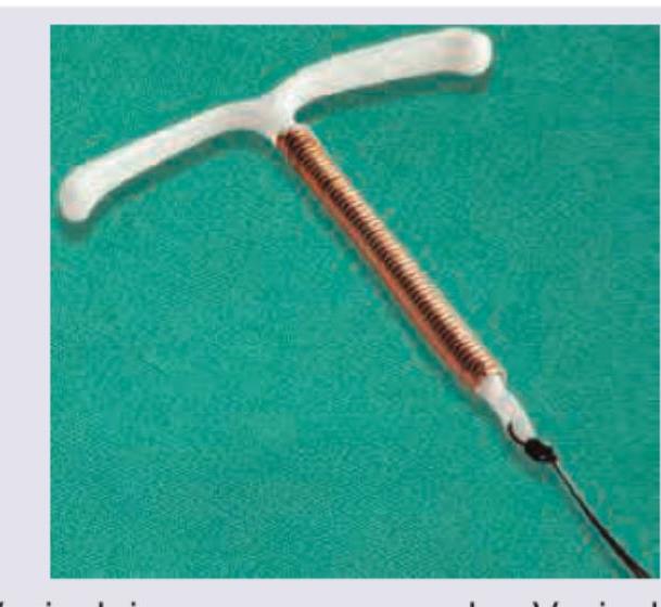 Image for question 545