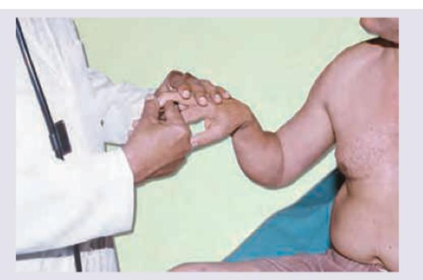 Image for question 753