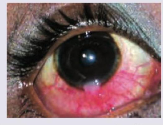 Image for question 260