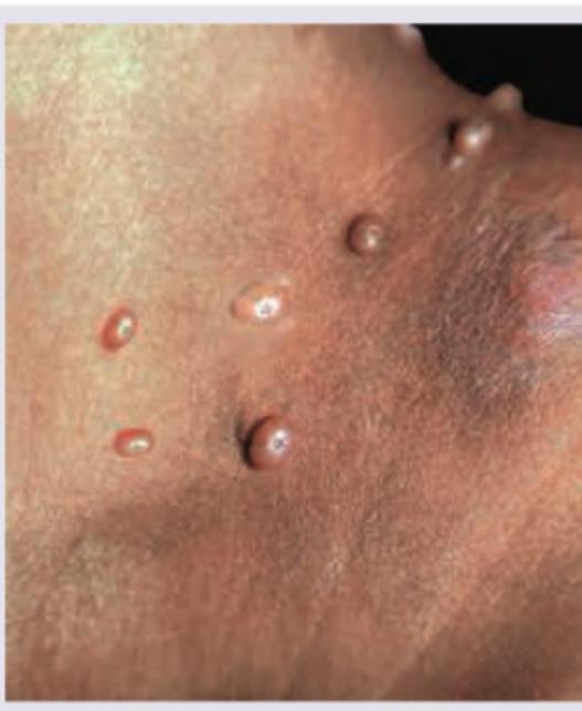 Image for question 168